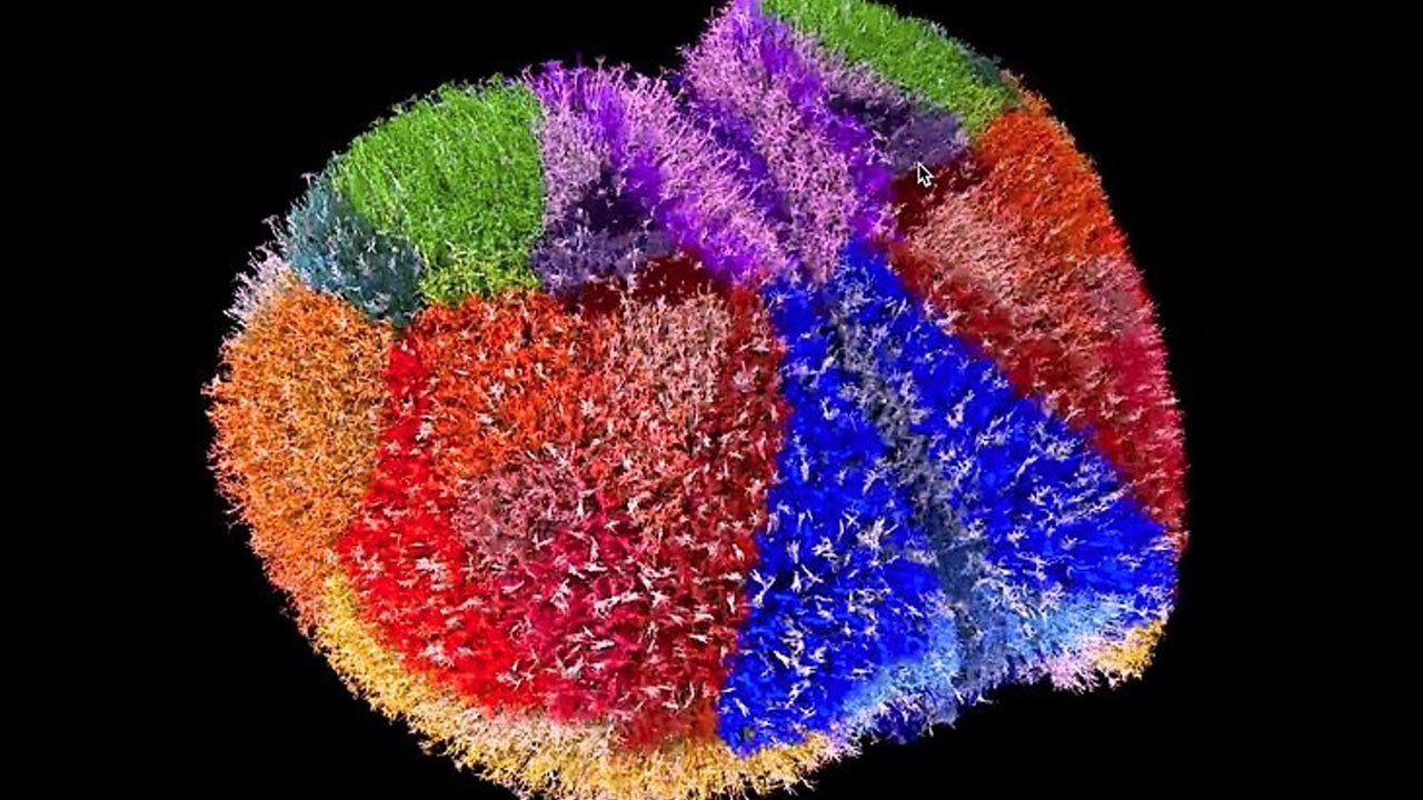 Bilim tarihinde bir ilk: Gelmiş geçmiş en detaylı beyin haritası çıkarıldı