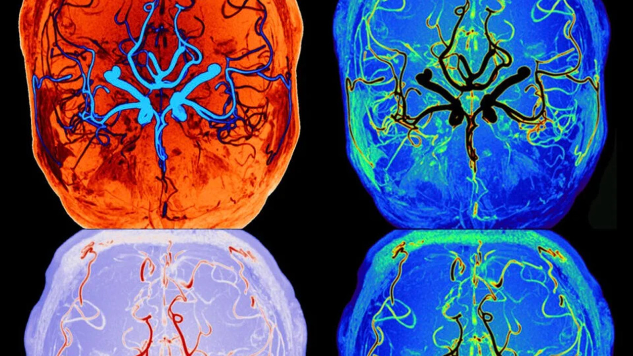 Biz uyurken, beynimiz de aslında temizlik yapıyormuş