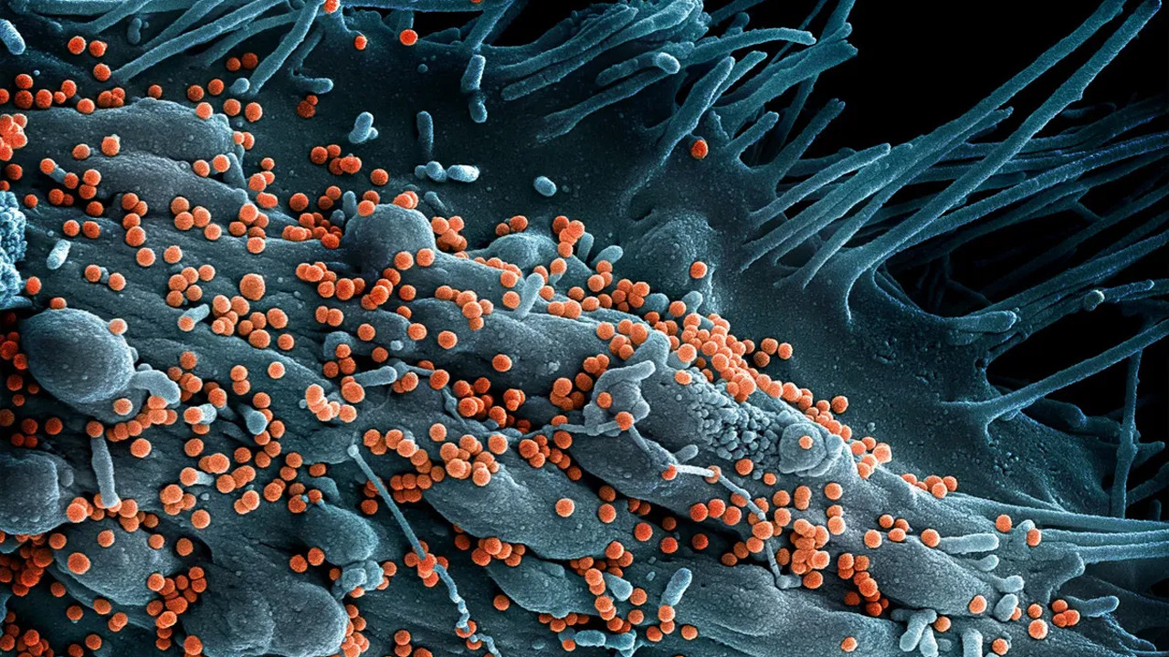 Lujo virüsü: %80 ölüm oranıyla gelen sessiz tehlike