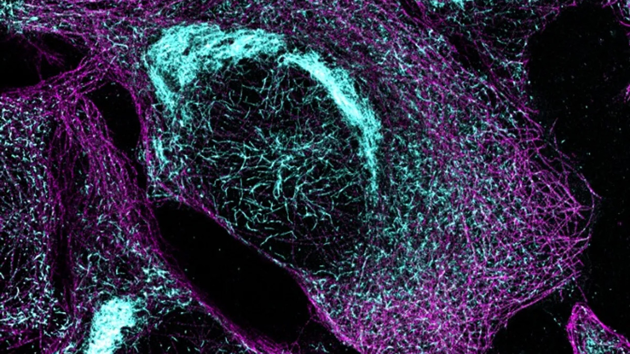 Basit bir kan testi Alzheimer'in hangi aşamada olduğunu gösterebiliyor